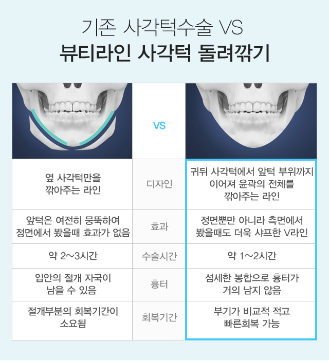 기존 사각턱수술 vs 뷰티라인 사각턱 돌려깎기 비교