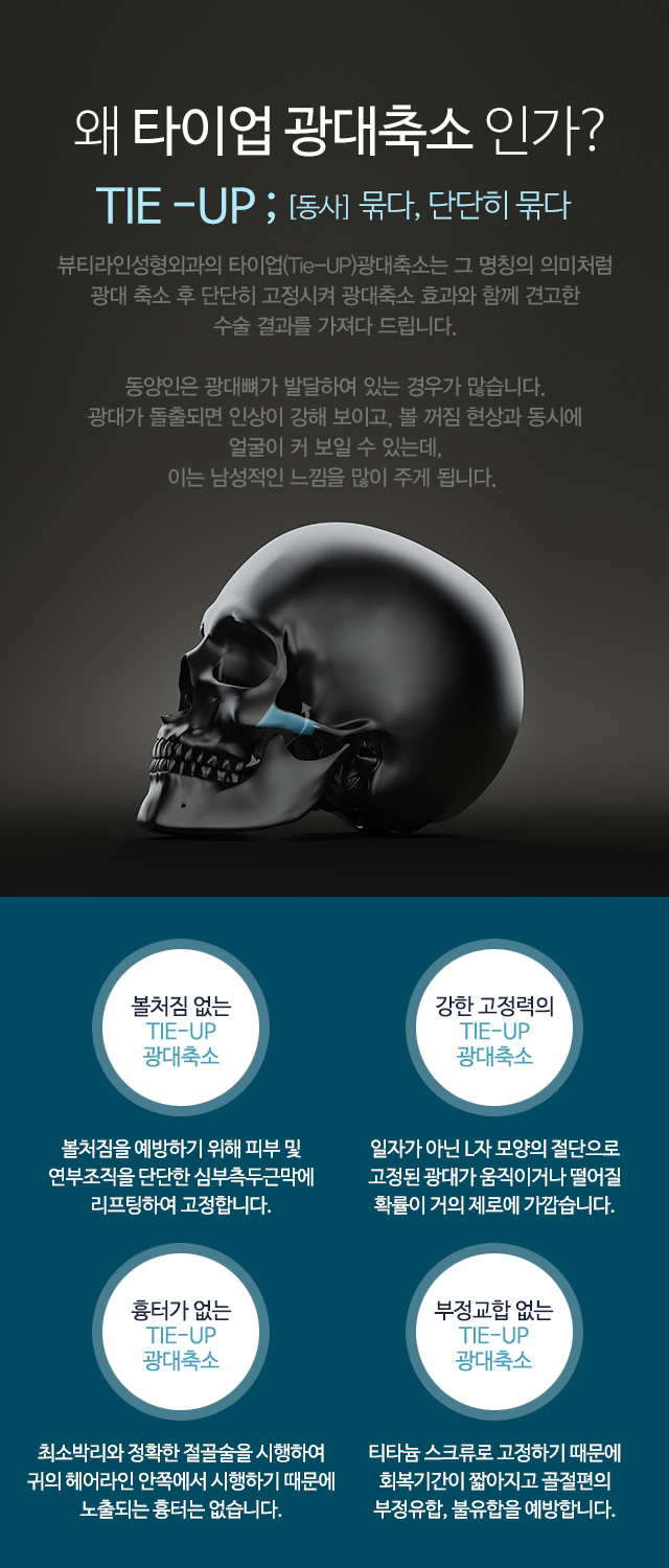 WHY, Tie UP?왜 타이업 광대축소 인가?뷰티라인성형외과의 타이업(Tie-UP)광대축소는 그 명칭의 의미처럼 광대 축소 후 단단히 고정시켜 광대축소 효과와 함께 견고한 수술 결과를 가져다 드립니다. 동안인은 광대뼈가 발달하여 있는 경우가 많습니다. 광대가 돌출되면 인상이 강해 보이고, 볼 꺼짐 현상과 동시에 얼굴이 커 보일 수 있는데, 이는 남성적인 느낌을 많이 주게 됩니다.//볼처짐 없는 Tie-UP 광대축소-볼처짐을 예방하기 위해 피부 및 연부조직을 단단한 심부측두근막에 리프팅하여 고정합니다./강한 고정력의 Tie-UP 광대축소-일자가 아닌 L자 모양의 절단으로 고정된 광대가 움직이거나 떨어질 확률이 거의 제로에 가깝습니다./흉터가 없는 Tie-UP광대축소-최소박리와 정확한 절골술을 시행하여 귀의 헤어라인 안쪽에서 시행하기 때문에 노출되는 흉터는 없습니다./부정교합 없는 Tie-UP 광대축소-티타늄 스크류로 고정하기 때문에 회복기간이 짧아지고 골절편의 부정유합, 불유합을 예방합니다.